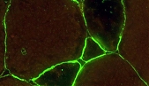 New research by the Laboratory of Molecular and Cellular Biology on the composition of the symbiotic interface in legume nodules of various types.